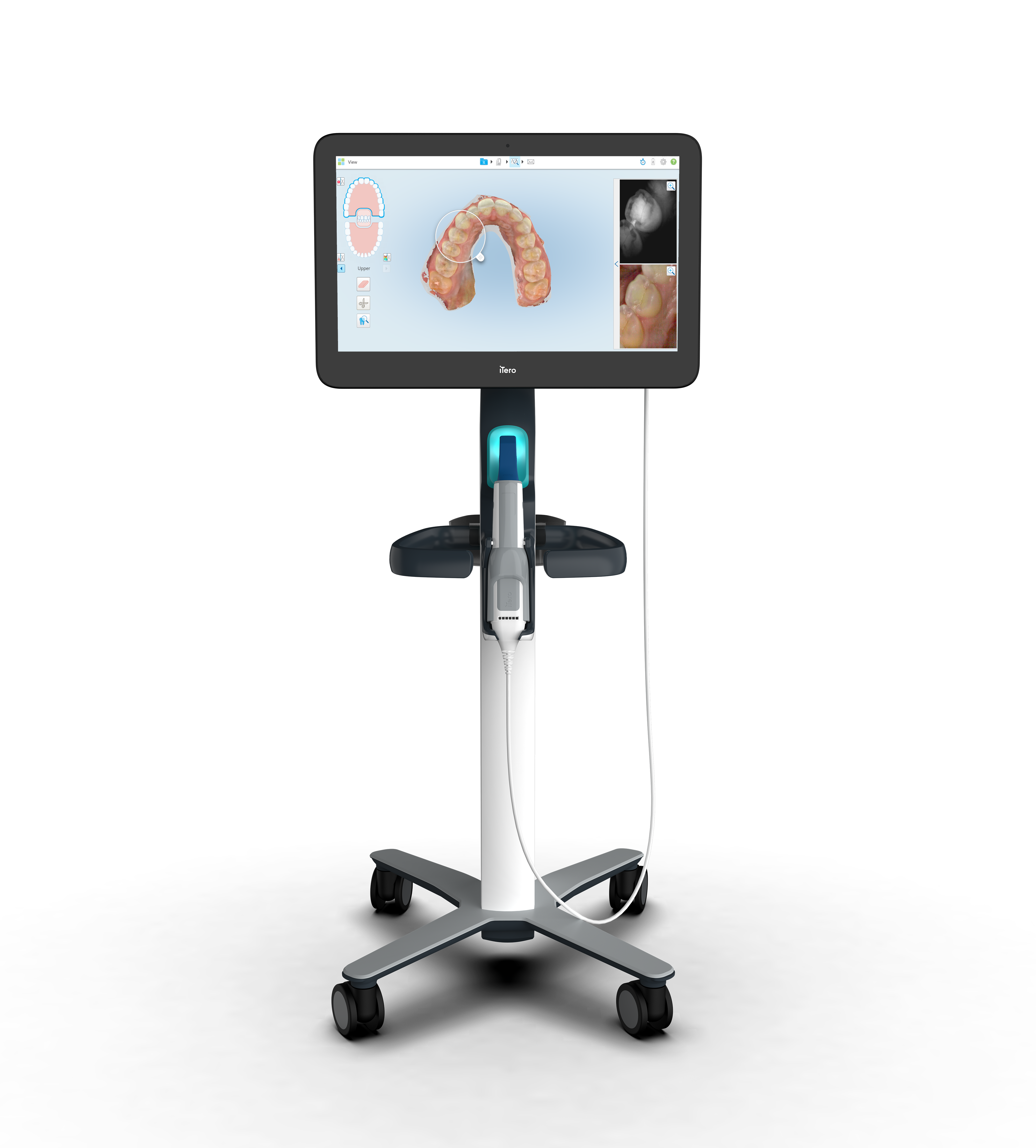itero element 5d intraoral scanner