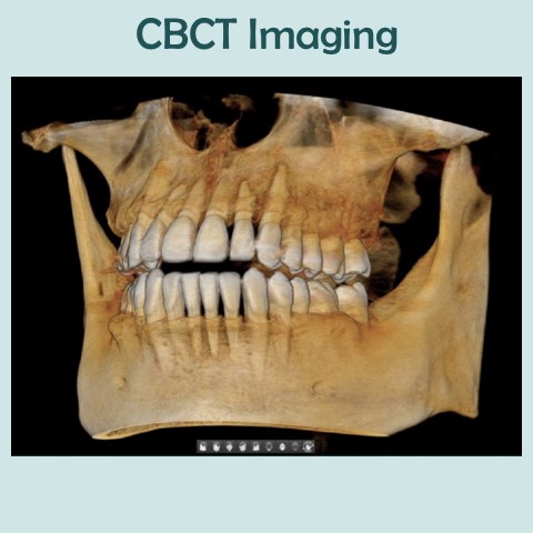 Cone beam imaging displays teeth and jaws.