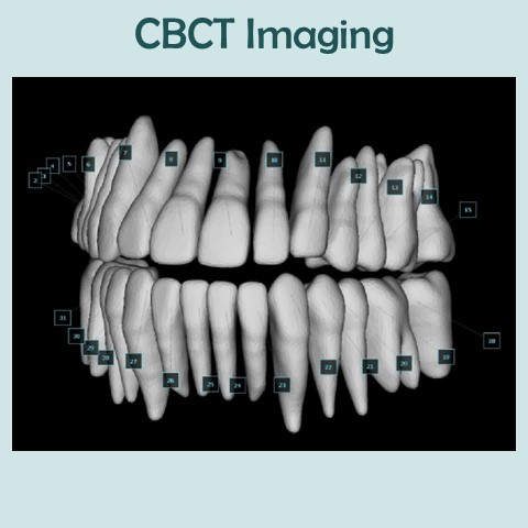 Teeth isolated and observed with advanced imaging software.